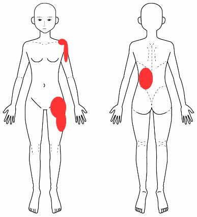 腰痛 大腿神経痛 肩関節周囲炎 腕が痛い 多治見市の整体 外出困難な重症者 子育て中の女性宅へ訪問