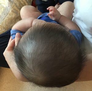 赤ちゃんの頭蓋矯正　絶壁頭