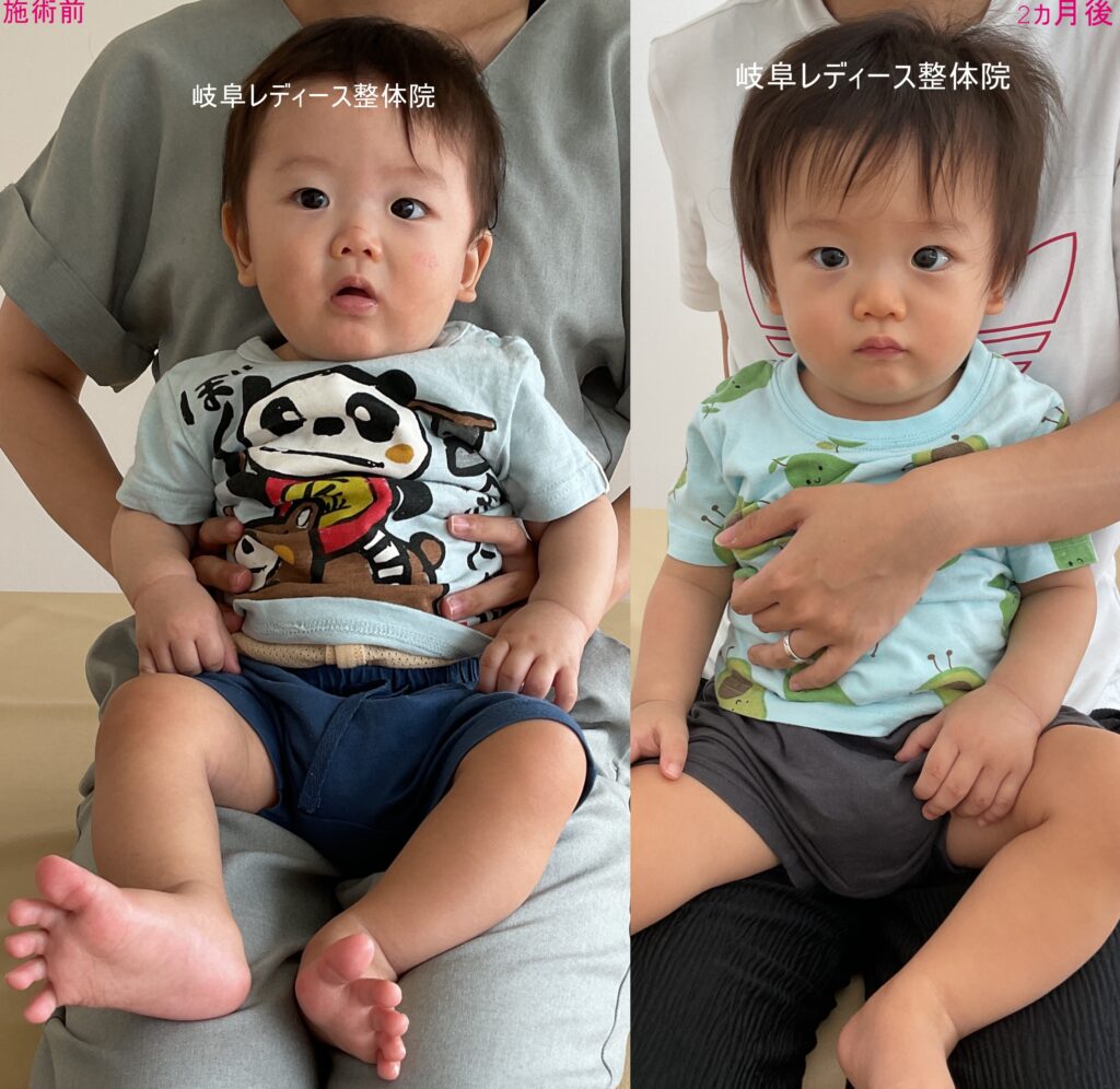 絶壁頭・ハチ張り