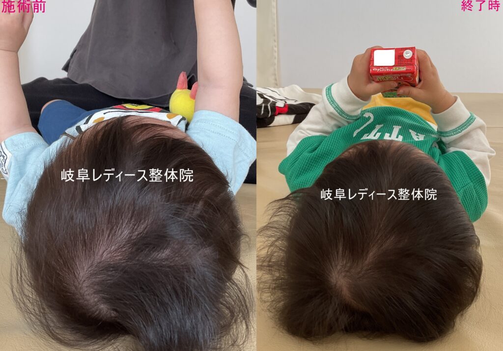 絶壁頭・ハチ張り