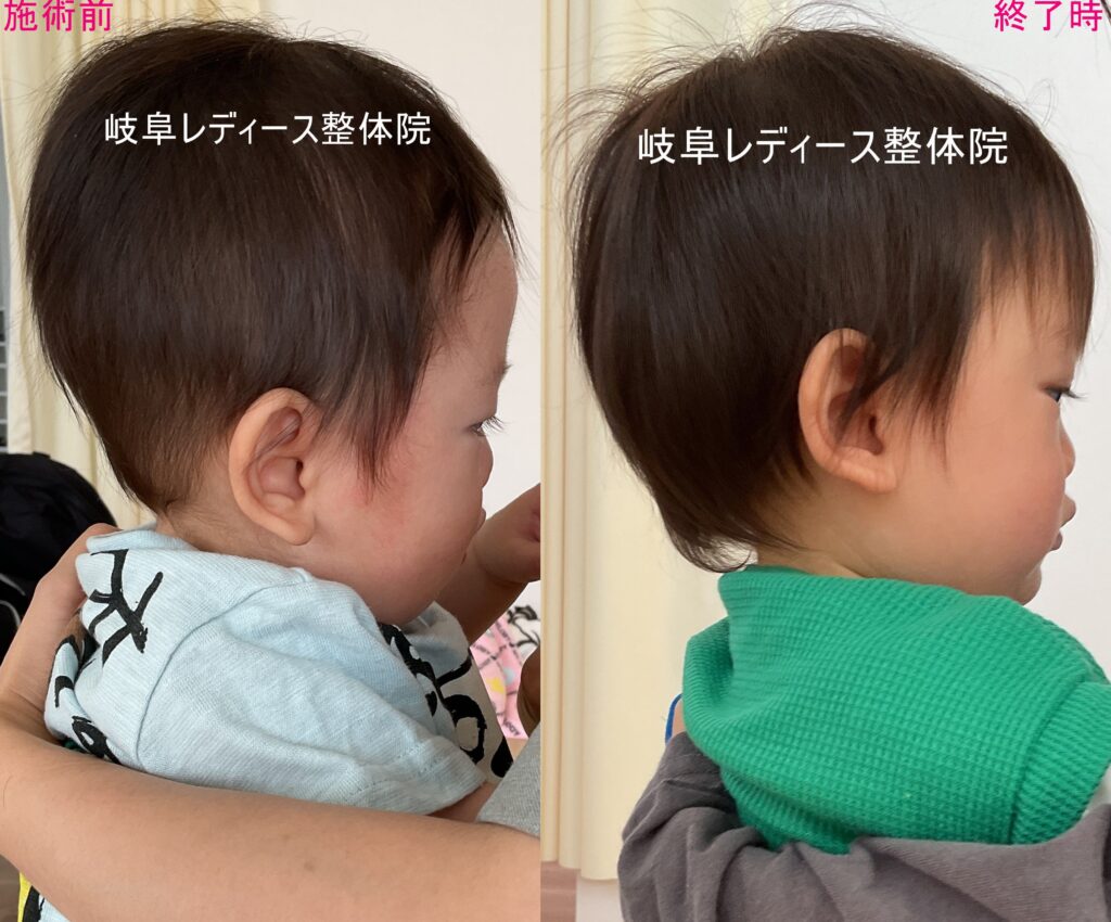 絶壁頭