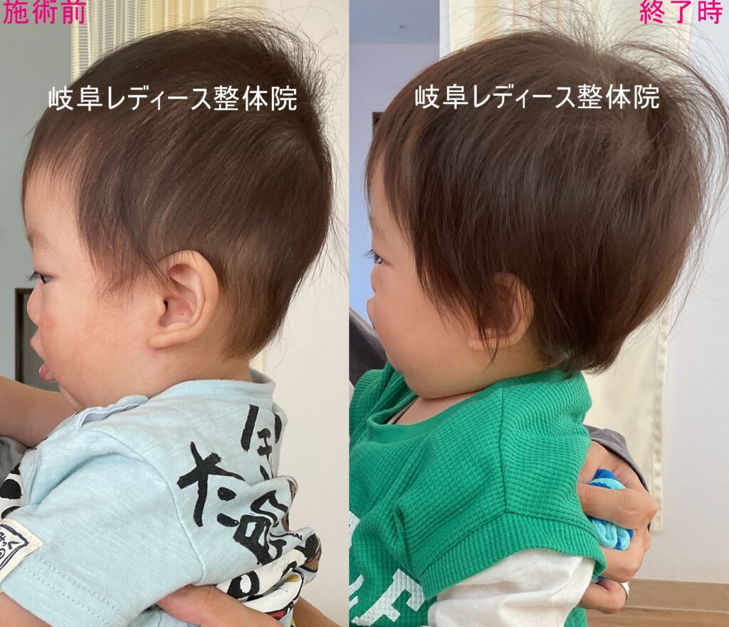 絶壁頭